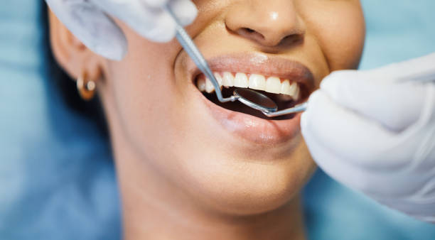 Best Teeth Whitening  in Genoa, IL