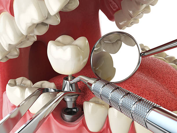 Best Dentist for Tooth Abscess  in Genoa, IL
